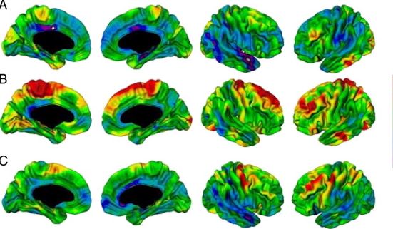 brain