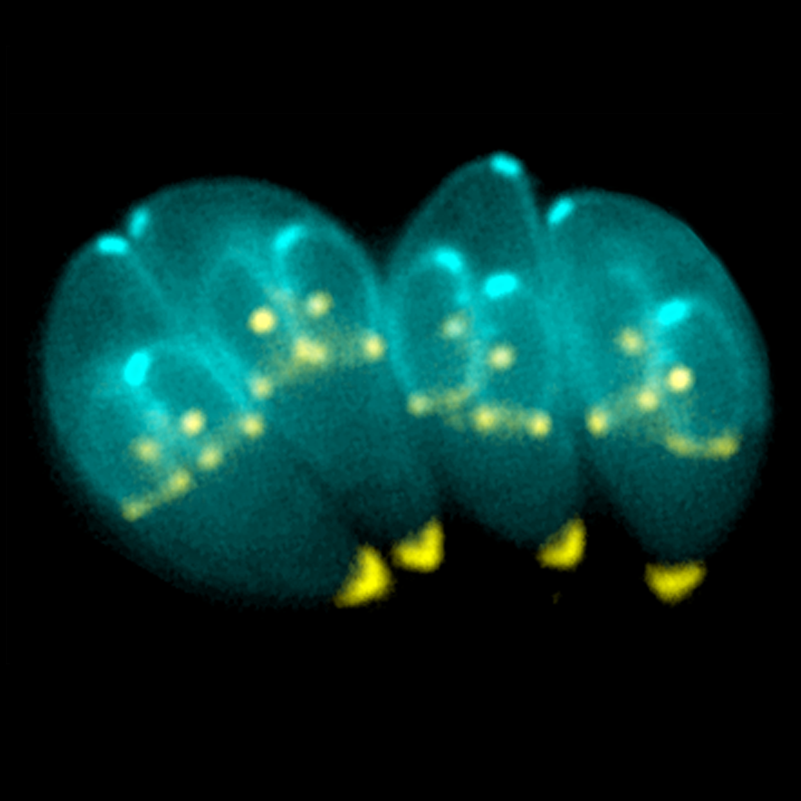 toxoplasma gondii
